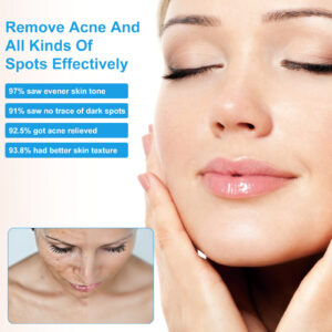 Product image for  Desalting Pimple Spot Emulsion Reduces Closed Mouth Home Décor 10