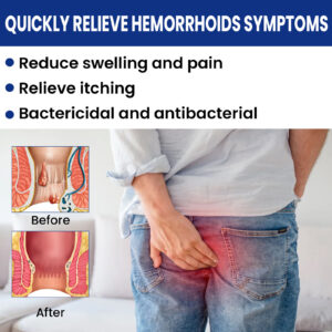 Product image for  Hemorrhoid Cream Meat Ball Anti Itching Cold Compress Soothing Repair Gel Home Décor 15