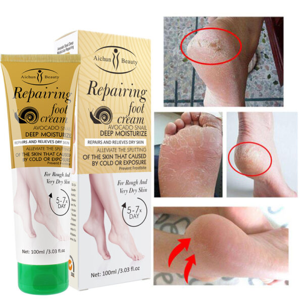 Product image for  Foot Rejuvenation To Prevent Chapped And Dry Skin Home Décor 7